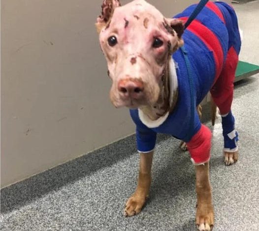 Severely Burned Pit Bull Overcame The Odds And Now Enjoys Life