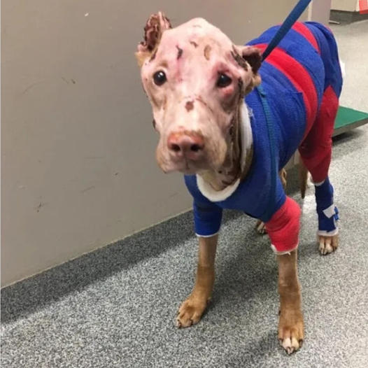 Severely Burned Pit Bull Overcame The Odds And Now Enjoys Life